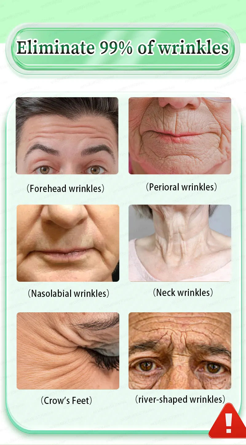 100% wrinkles disappear Serum