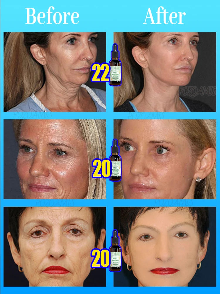 100% wrinkles disappear Serum