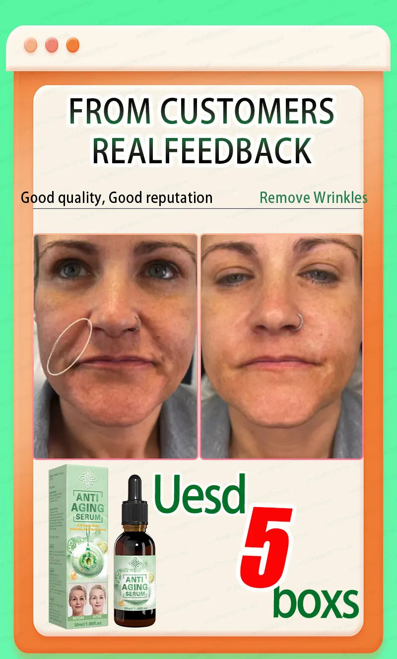 100% wrinkles disappear Serum