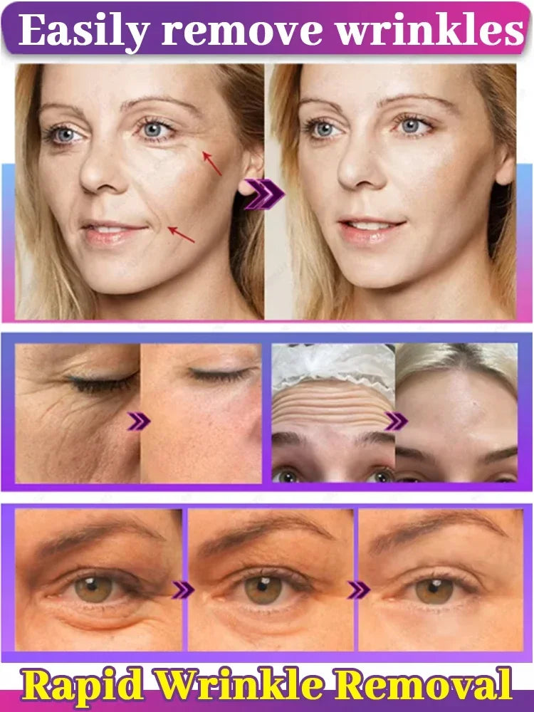 100% wrinkles disappear Serum