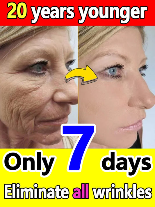 100% wrinkles disappear Serum