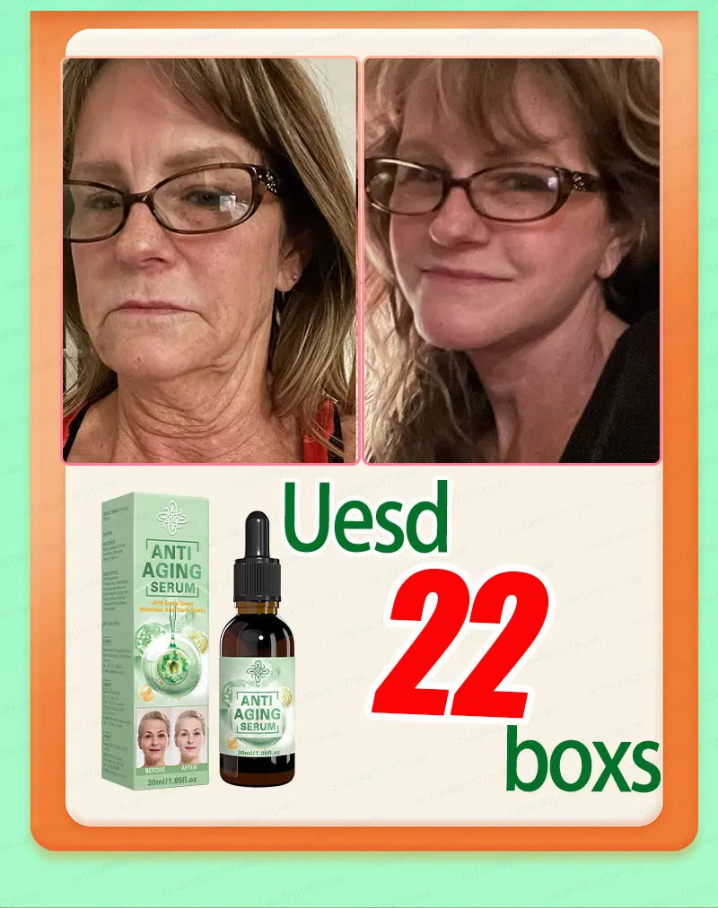 100% wrinkles disappear Serum