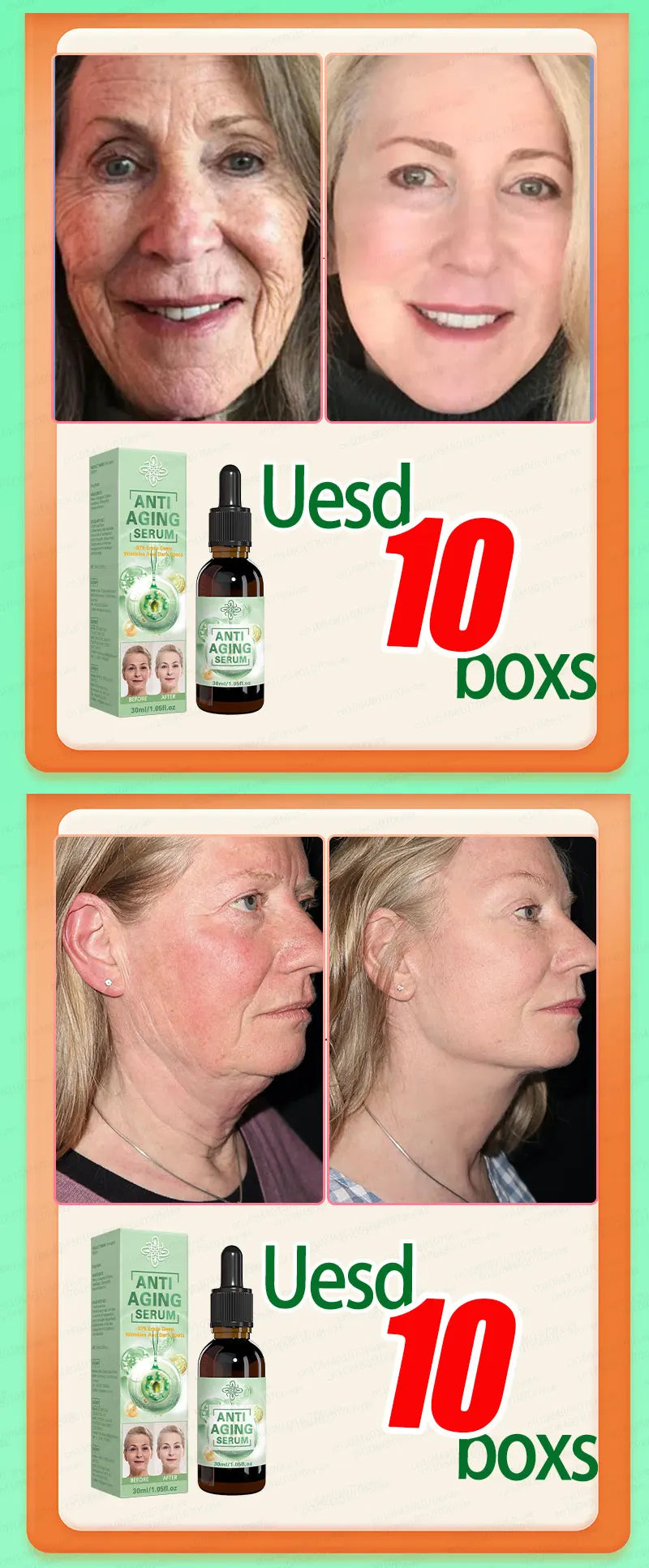 100% wrinkles disappear Serum