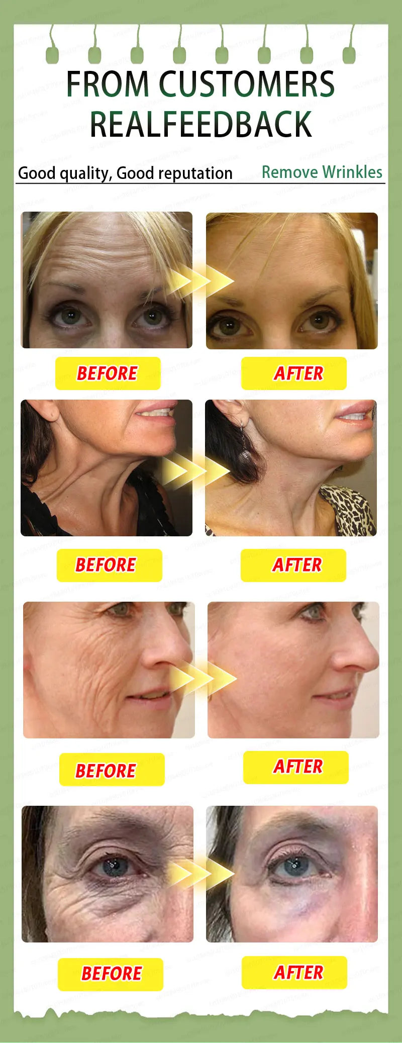 100% wrinkles disappear Serum