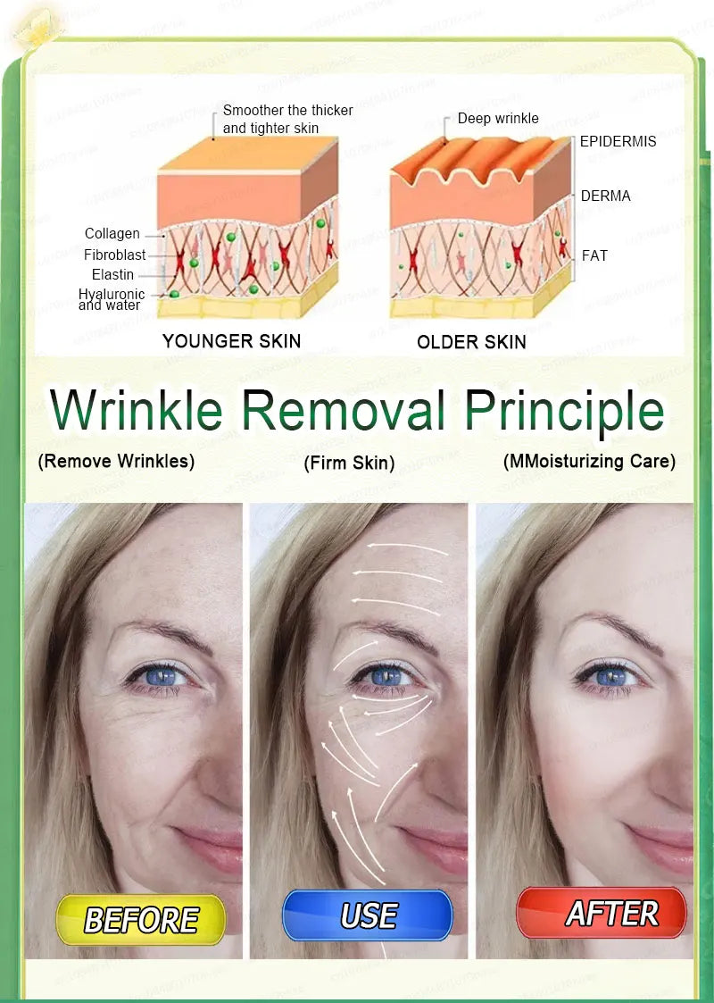100% wrinkles disappear Serum