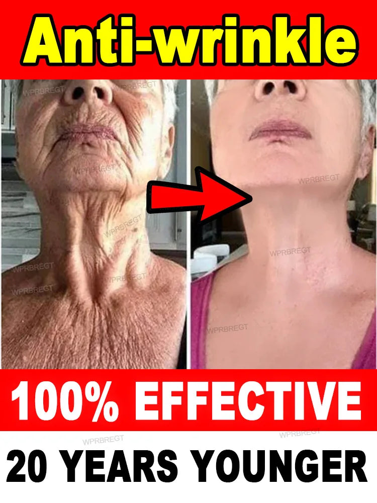 100% wrinkles disappear Serum